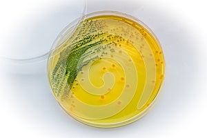 Vibrio cholerae:Gram-negative, comma shaped bacterium.