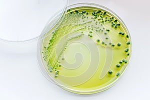 Vibrio parahaemolyticus: Gram-negative,