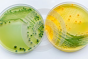 Vibrio parahaemolyticus and Vibrio cholera