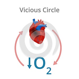 Vicious circle simplified vector diagram