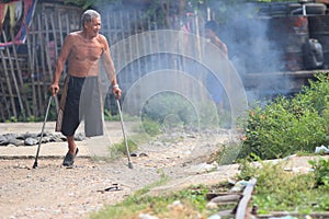 A victim of Khmer Rouge mines in Cambodia