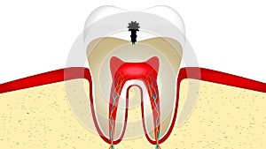 Video animation of crop of tooth