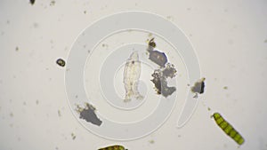 Video of a bdelloid rotifer under the microscope