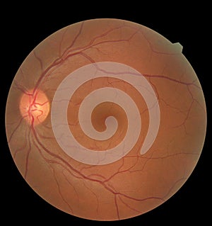 View inside human eye showing retina, optic nerve and macula. Health concept