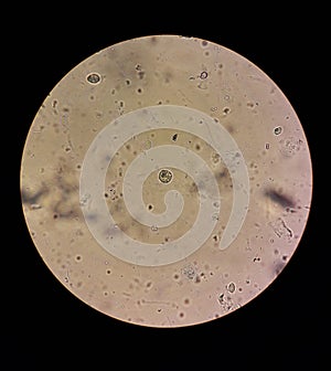 View in the microscope on Trichomonas STD photo