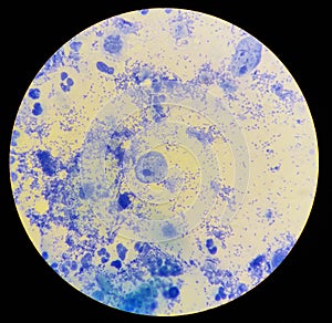 View in the microscope on Trichomonas painted with methylene blue, cytological smear photo