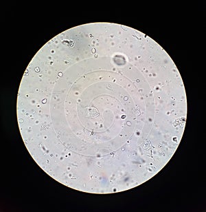 View in the microscope on Trichomonas STD photo