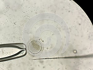 View through microscope at in vitro fertilization process