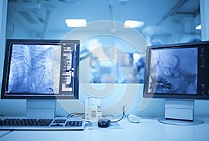 View of modern medical X-ray operating room (cath lab)