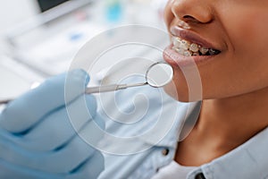 View of orthodontist in latex glove holding dental mirror near happy african american patient in braces