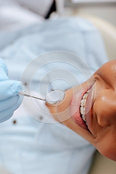 View of orthodontist in latex glove holding dental mirror near happy african american patient in braces