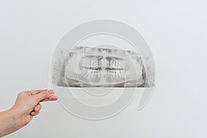 View on radiography of the jaw. Dental x-ray of pacient oral cavity with teeth