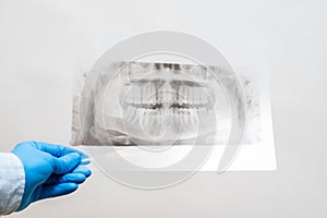 View on radiography of the jaw. Dental x-ray of pacient oral cavity with teeth