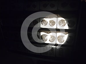 View of the results of computed tomography of the lungs