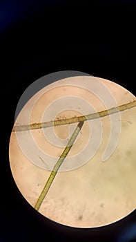 Microscopic View of Cladophora sp.