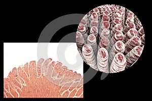 Villi of small intestine