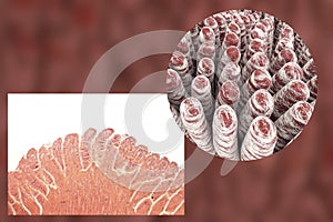 Villi of small intestine