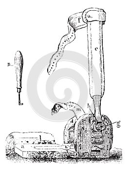 Vincent Duval device for clubfeet, vintage engraving