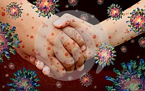 Viral Diseases