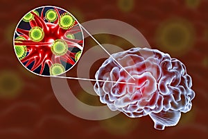 Viral encephalitis illustration