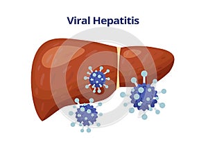 Viral hepatitis, damages liver and viruses vector flat illustration isolated on white background. photo