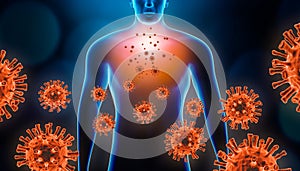 Viral pneumonitis 3d rendering illustration with red virus cells and human body. Coronavirus, covid 19, infectious and