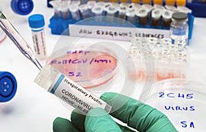 Virologist working on exogenous Sars-CoV-2 virus RNA sequence in the laboratory, conceptual image