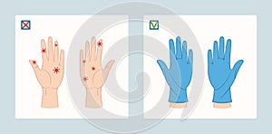 Virus on humans hands and hands in medical gloves. Vector flat style illustration isolated on white background