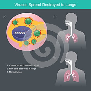 Virus spread destroyed to lungs, Illustration show different the lungs human from CORONAVIRUSES