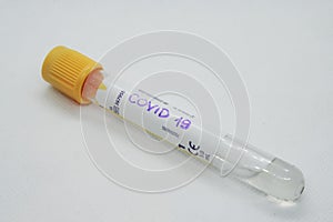 Virus test tube. Testing virus. Viral infection test.