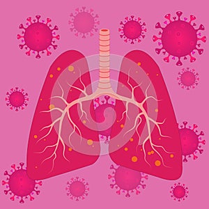 Viruses and bacteria infect Human lungs. lung disease. vector photo