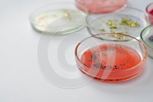 Viruses and bacteria in a Petri dish, studying the growth of bacteria on different samples in the laboratory.