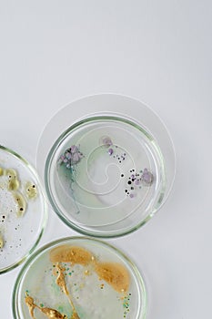 Viruses and bacteria in a Petri dish, studying the growth of bacteria on different samples in the laboratory.