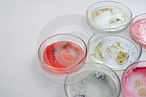 Viruses and bacteria in a Petri dish, various analyses in the laboratory. photo