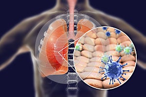 Viruses in human lungs photo