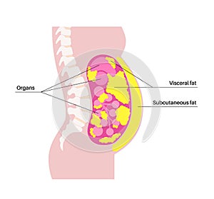 Visceral fat diagram