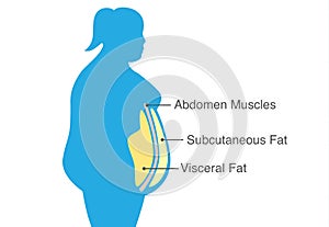 Visceral fat and subcutaneous fat that accumulate around waistline of woman.