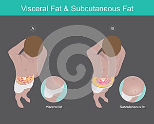 Visceral Fat & Subcutaneous Fat Illustration. Illustration knowledge of the abdomen visceral fat in human