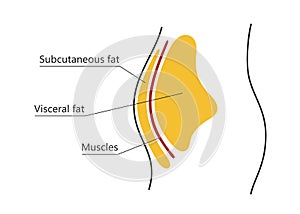 Visceral and subcutaneous fat around waistline. Location of visceral fat in abdominal cavity. Types of human obesity