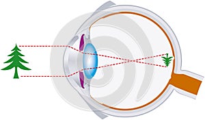 Visione bulbo oculare ottica lente sistema 