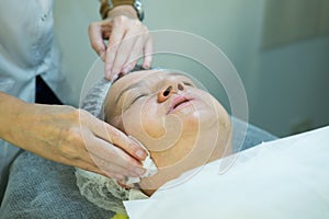 A visit to a beautician. Doctor beautician prepares the patient`s face for the procedure - carboxytherapy. The preparatory stage