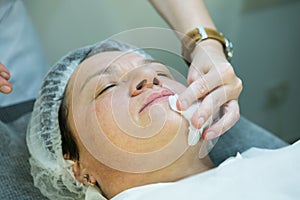 A visit to a beautician. Doctor beautician prepares the patient`s face for the procedure - carboxytherapy. The preparatory stage