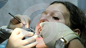 Visit to the dentist. A dentist is drilling a tooth for a girl with braces. Stomatologist makes a patch of a seal