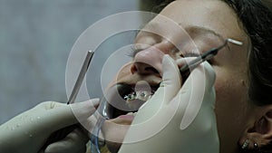 Visit to the dentist, installation of the bracket system and correction of the malocclusion. Orthodontist corrects the