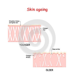 Visual representation of skin changes over a lifetime photo