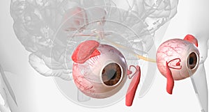 The visual system contains the eyes, optic nerves, optic tracts, and visual cortex