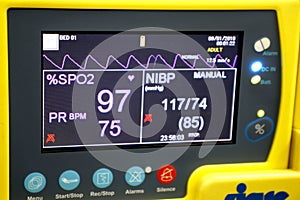 Vital signs monitor