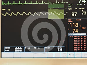 A vital signs monitor displaying a patient`s ECG, pulse oximetry waveform, blood pressure and other vital signs in an operating th