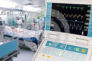 Vital Signs Monitor for Intra-Aortic Balloon Counterpulsation in ICU photo