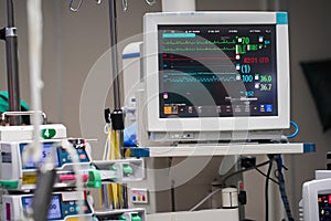 Vital signs monitor with machines during surgery